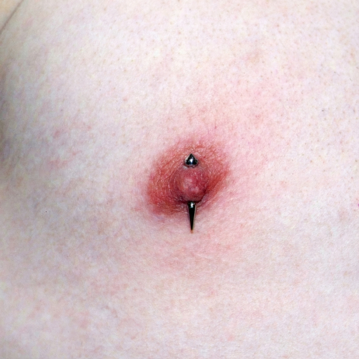 Vertical Nipple