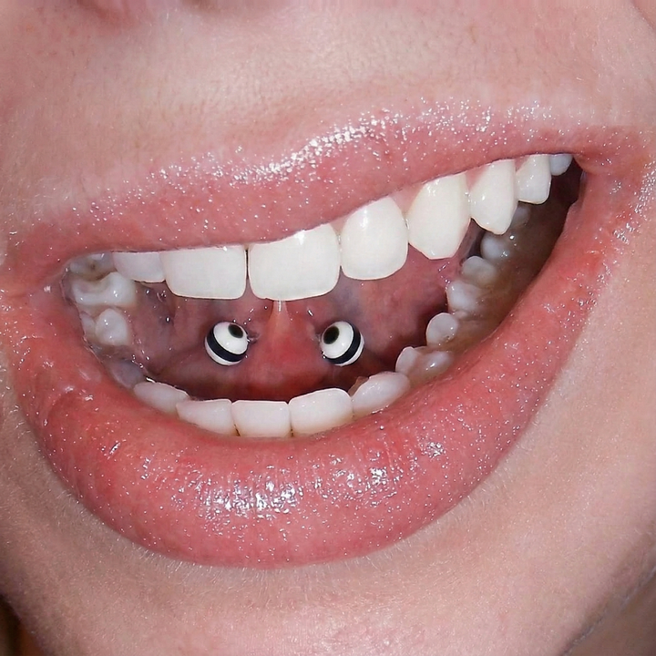 Tongue Web